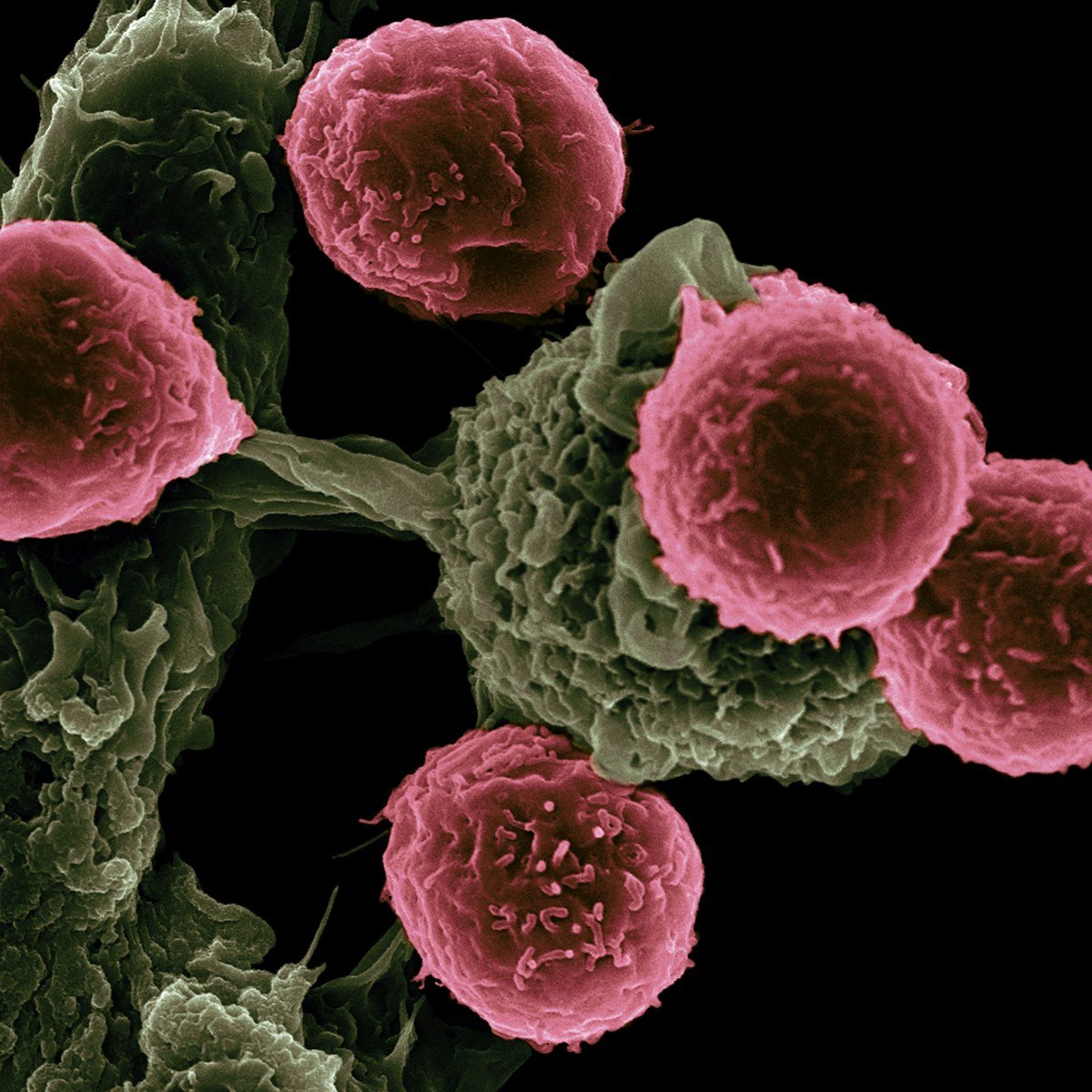 Pink spherical cells attached to a textured green structure against a black background